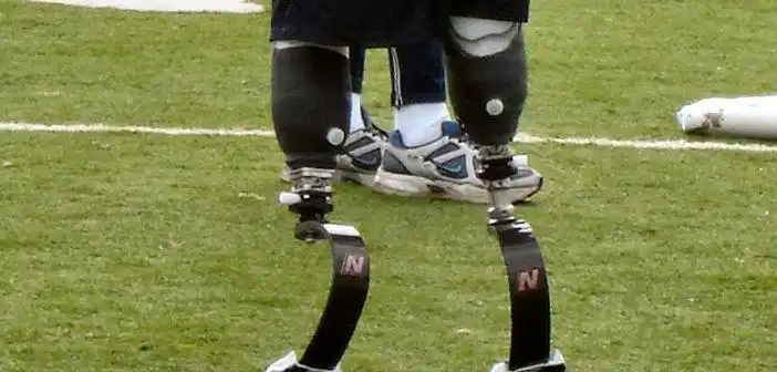 详解腿部假肢的训练方法