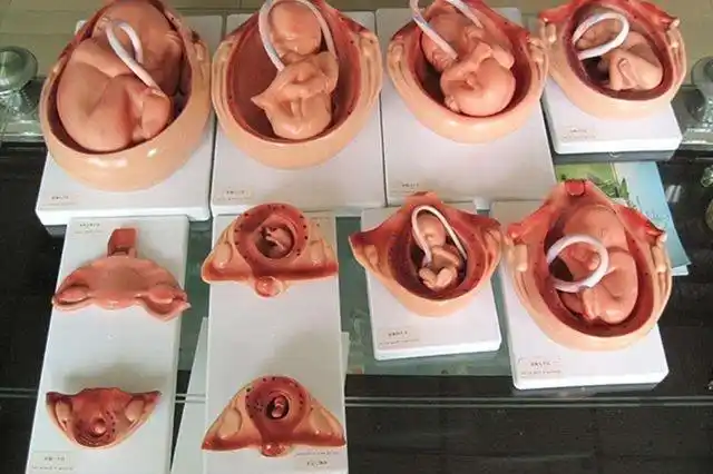 胎儿有了心跳之后,请别选择"打掉"他,因为引产过程实在残忍_人工流产