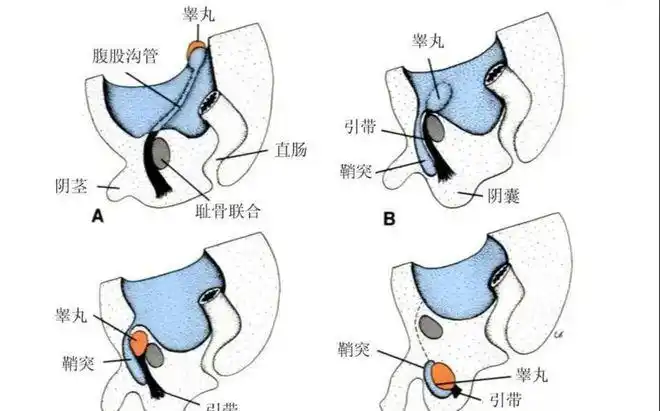 高贵!睾丸穿刺手术全过程痛吗"成果展示"-第1张图片-西卡博客