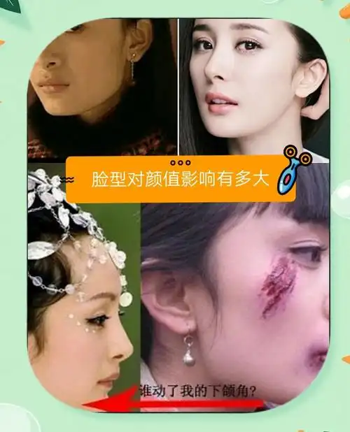 杨幂颜值蜕变记:下颌角手术揭秘