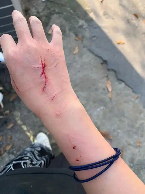 被猫咬是一种什么体验?