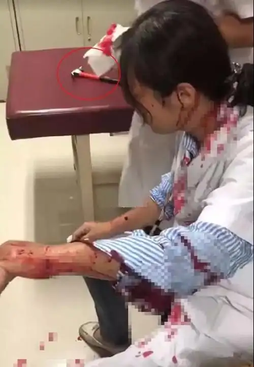 突发河北女医生刚被锤伤浙江又一医生被砍重伤