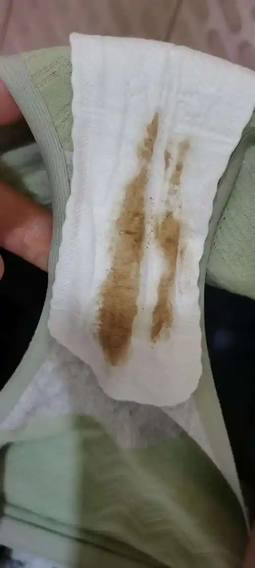 爆料!怎么确认是排卵期出血"消遥自在"-第1张图片-樱花博客