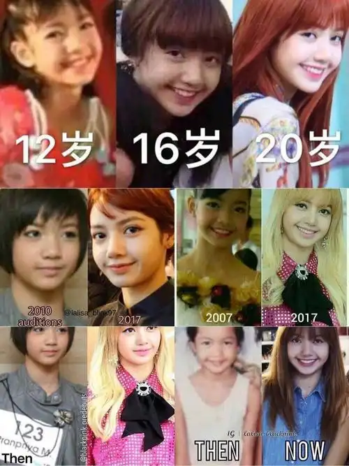 澄清lisa到底有没有整容