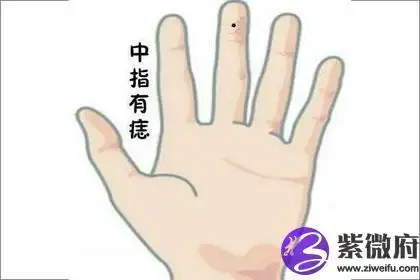 手上长痣 揭秘手上中指痣的含义