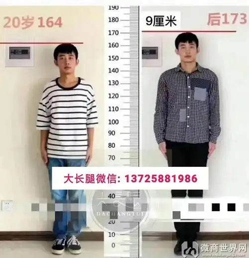 穿大长腿多久长高5厘米需要配合哪些饮食和运动