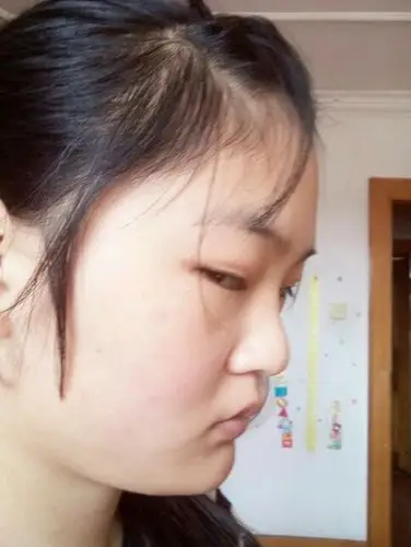 请问下巴往前翘吗?