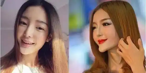 盘点娱乐圈整容失败的明星,个个让人不忍直视!