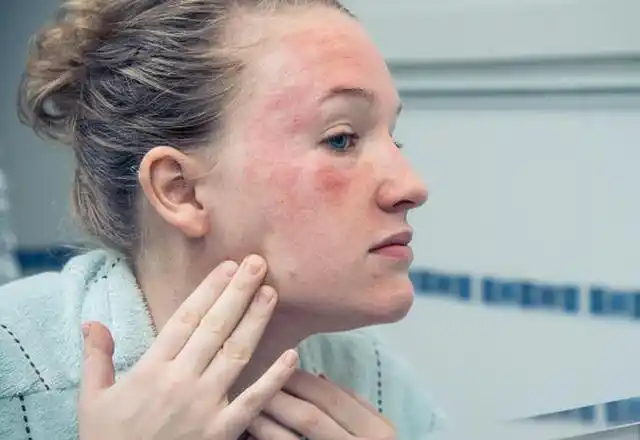 敏感肌怎么判断 敏感肌肤修复方法-5号网