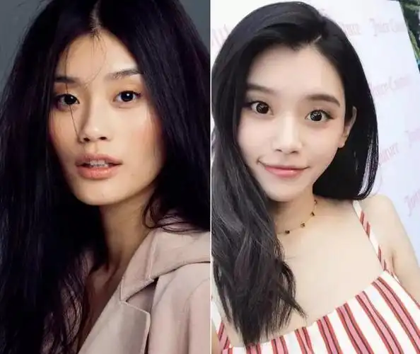 奚梦瑶整容了鼻头缩小面部填充明显秀鸽子蛋大钻戒超奢侈