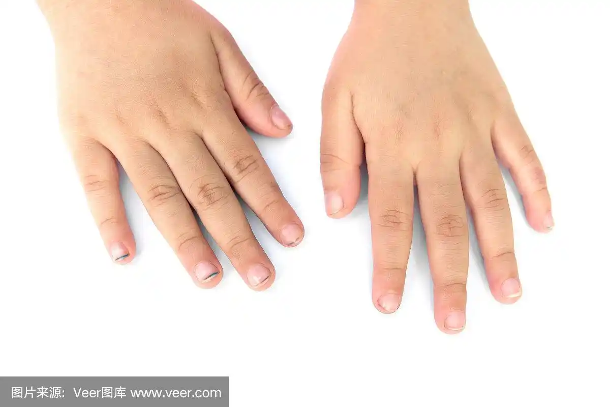 儿童脏指甲隔离