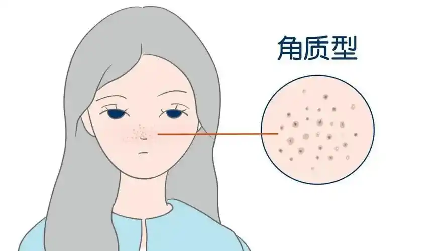 缩毛孔的正确打开方式! 图片-9