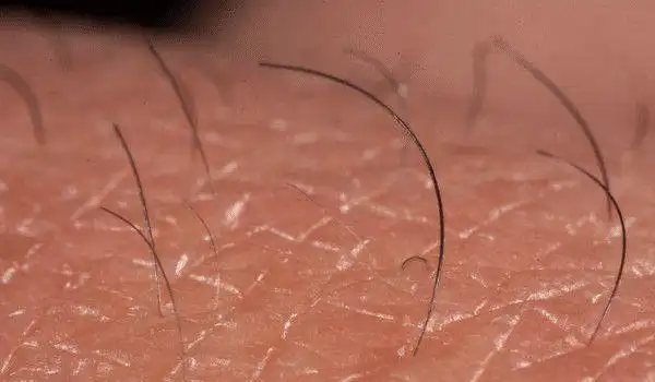 为什么肛门上会长毛?乳房上的毛能拔吗?别害羞,多了解_网易订阅