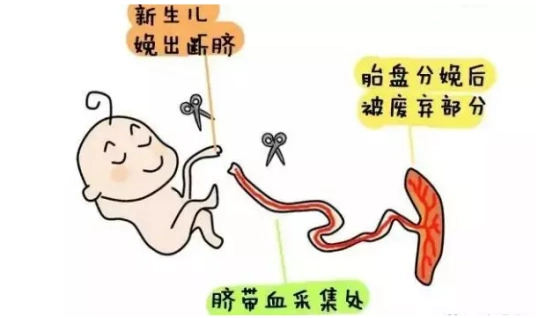 脐带血, 是胎儿娩出断脐后, 残留在胎盘和脐带中的血液. ▼