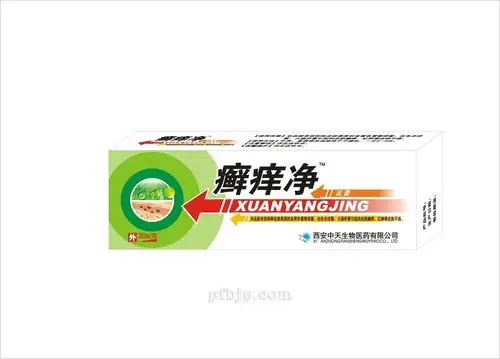 癣痒净 乳膏