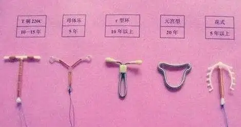 为什么不建议女人上环(为什么不建议女人上环会衰老)