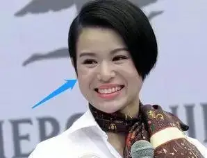 昆凌这个部位的问题,让她笑起来像哭!_颧骨