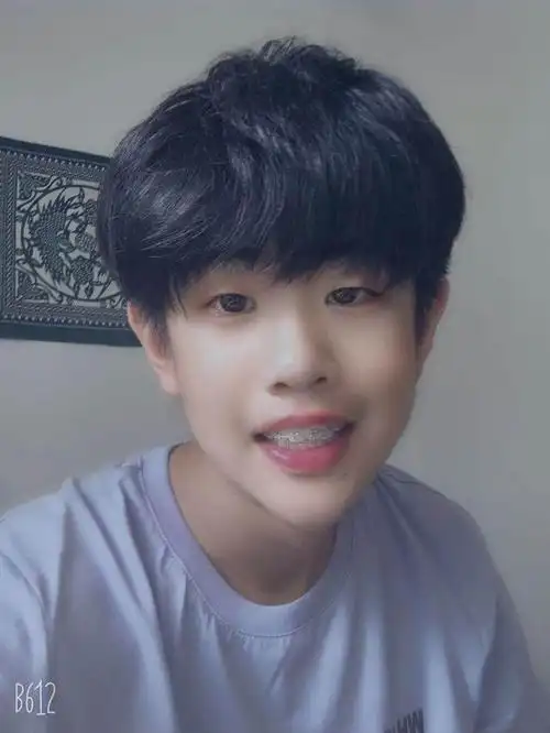 16岁小帅哥牙齿矫正五个月变化分享