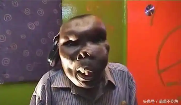 世界最丑的男人(实拍全世界最丑的男人)