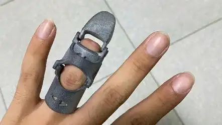 给朋友做个机械手指假肢,他很高兴