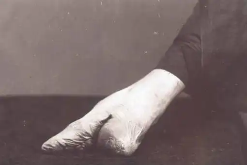 三寸金莲也就是俗称"裹小脚"