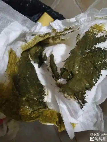 吃奶量少大便酸臭深绿有颗粒