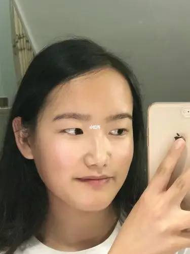 打卡真珠美学修复红血丝敏感肌第73天_敏感肌_红血丝修复_真珠美学