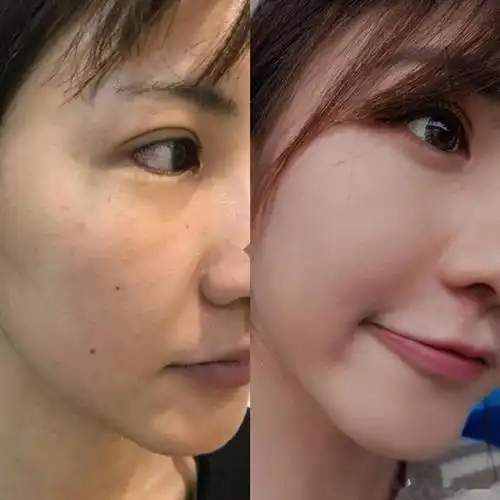 去斑产品真能去斑吗,美白淡斑效果好的护肤品合集