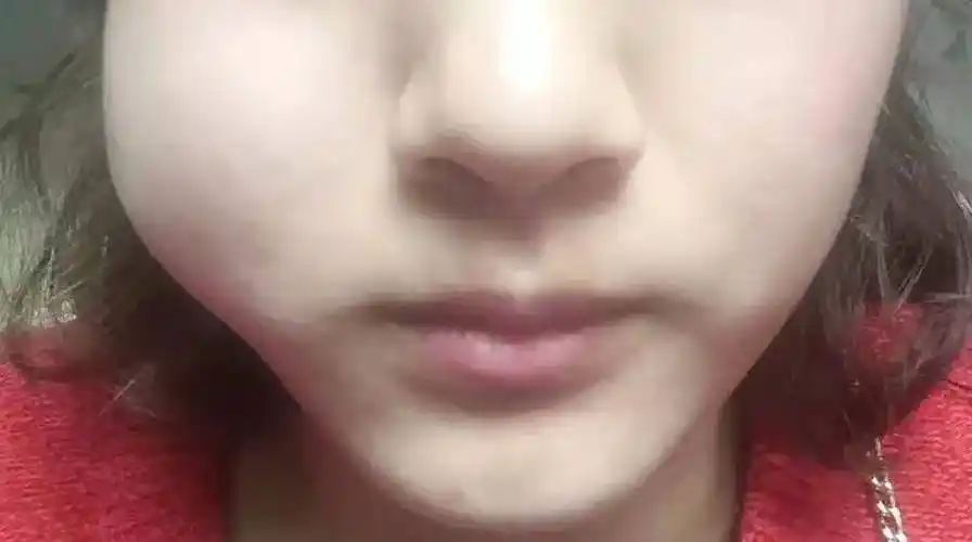 口腔诊疗问答实录医生我的智齿要拔吗拔牙疼吗拔完牙脸会不会变小