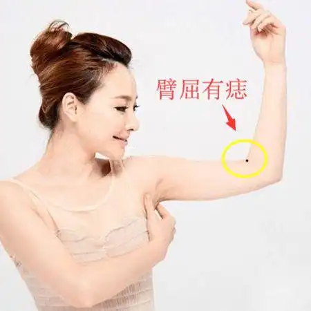手臂痣有这3颗财运旺桃花多富贵有望你有吗