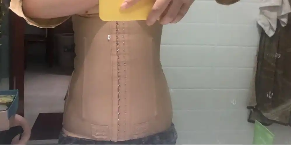 腰腹环吸妈妈臀手臂环吸第四天