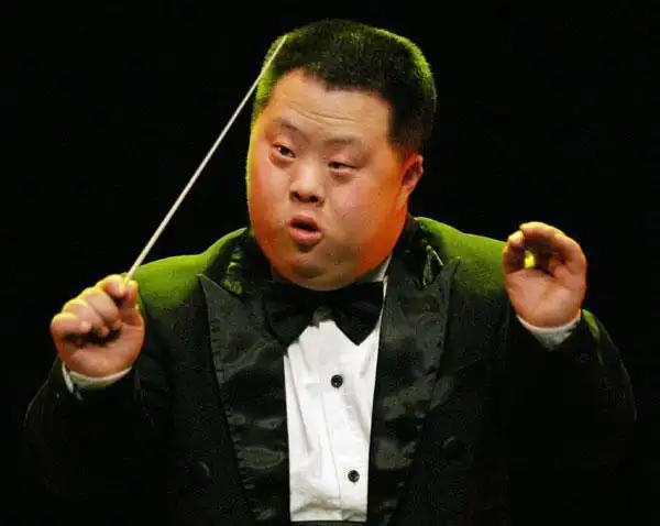 唐氏综合征是怎么引起的(唐氏综合征检查什么)_奇闻趣事_qq猎鹰乐园