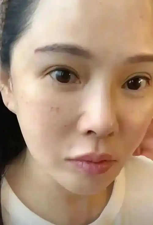 原创56岁伊能静赴韩国打水光针素颜出镜满脸针眼坦言真的很痛