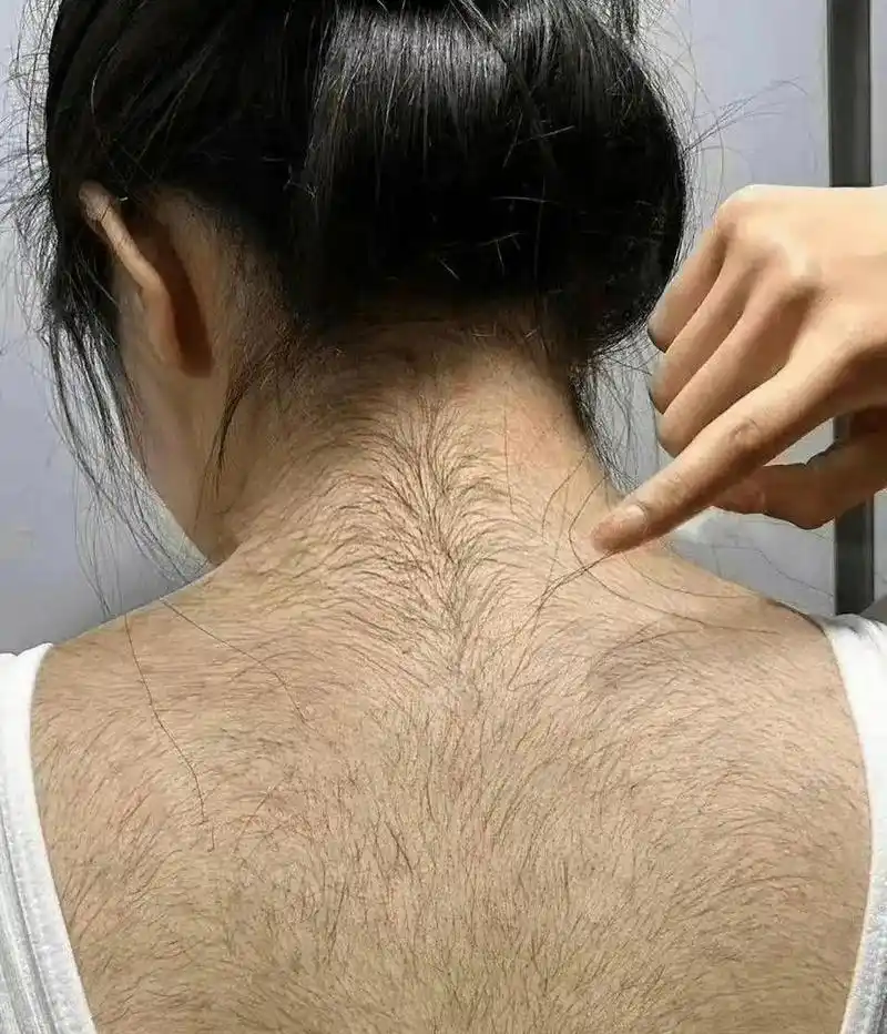 网友:男生会介意体毛多吗?