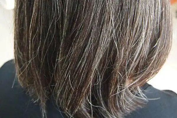 头顶长白发是癌症前期癌细胞会恶性增殖破坏正常的