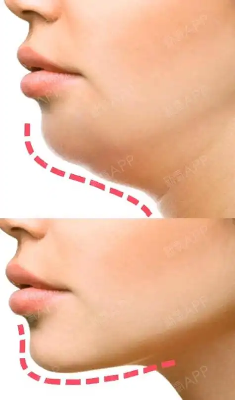 想要减双下巴我们要多按摩下巴到颈部的位置,这样不仅可以促进淋巴