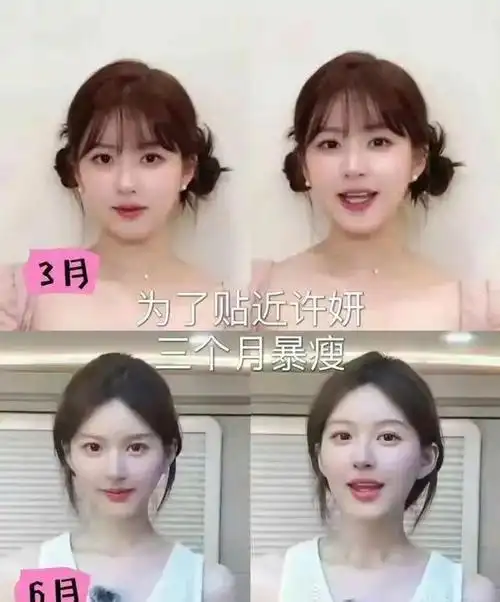 赵露思被质疑"整容",路透瘦成纸片,粉丝解释瘦了五官精致了