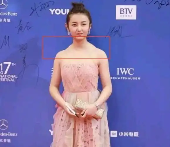 如果你的斜方肌很厚,那么你就需要注意你的日常生活习惯了.