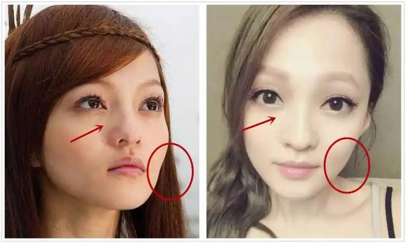 张韶涵36岁咸鱼翻生,靠的只是零毛孔少女脸吗?离天后,只差一