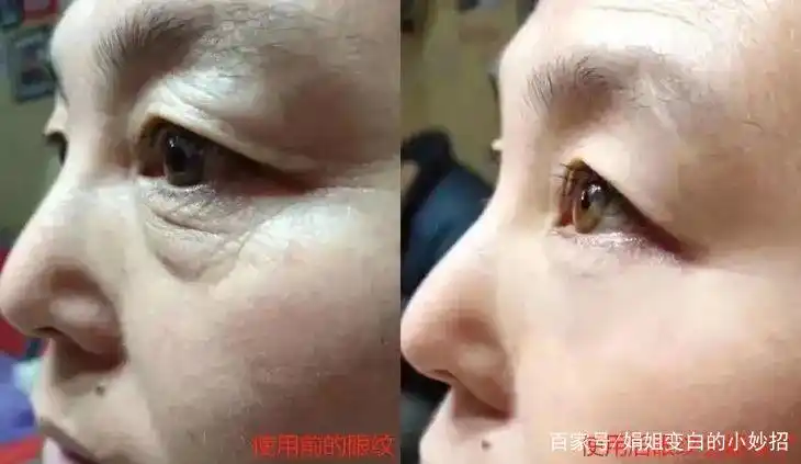 别再让眼纹暴露你年龄了这款眼霜淡化黑眼圈细纹却少有人知道