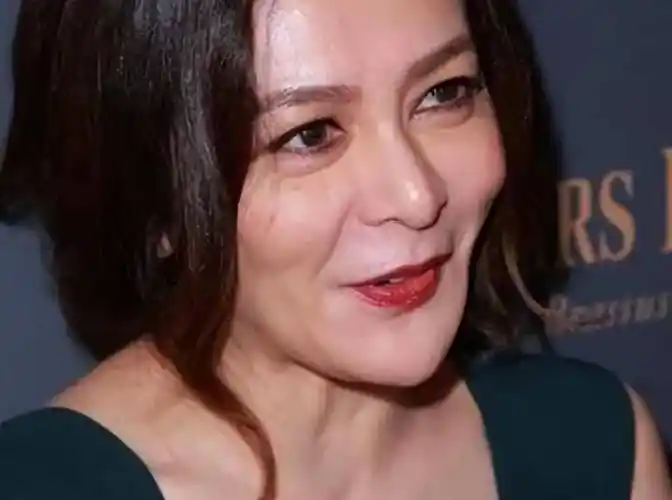 其实很多明星都受到了拉皮的影响,比如关之琳.