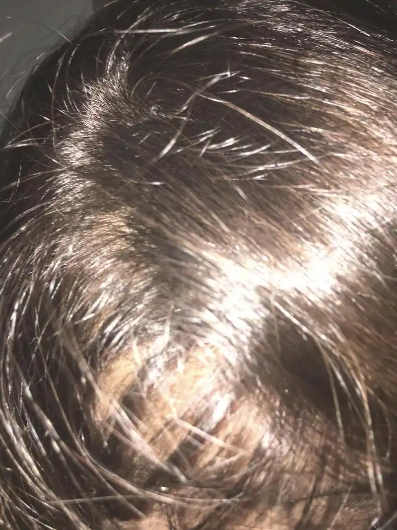 我的头发发根部位是黑色的