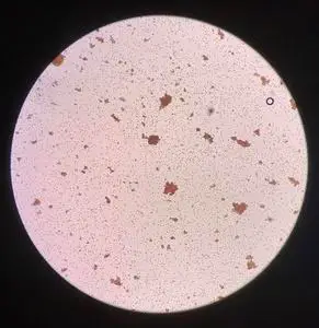 交叉配血试验中红细胞凝集不相容照片