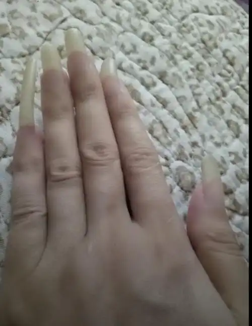 这是我14岁妹妹的长指甲,指甲是不是要断的样子
