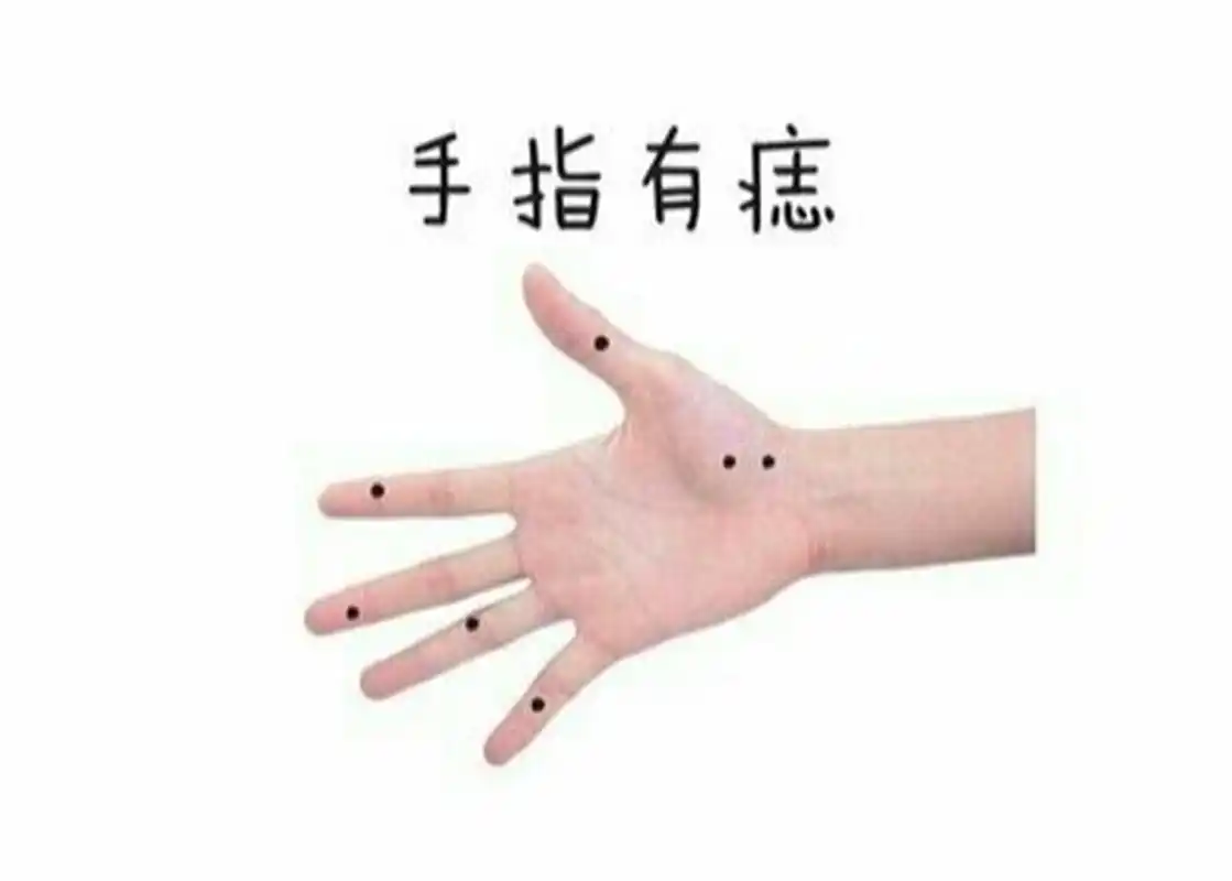 手指有痣好不好呢?