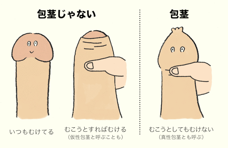 男孩包茎正确清洗可以减少花冤枉钱