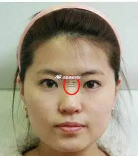 女人山根有横纹对自身的运势会有哪些影响呢