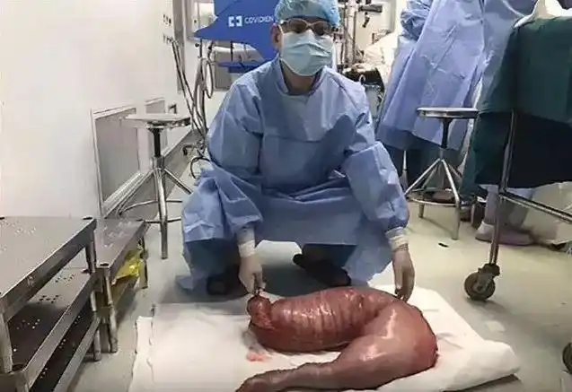 极限憋屎47天人类的身体会发生什么改变