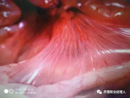 病毒性腹泻造成乳糜管内是空的