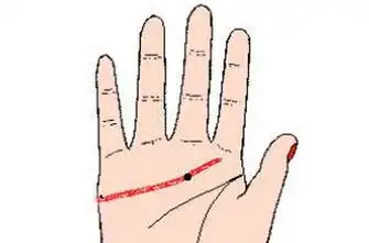 女人手上有痣掌心有痣相图解析!